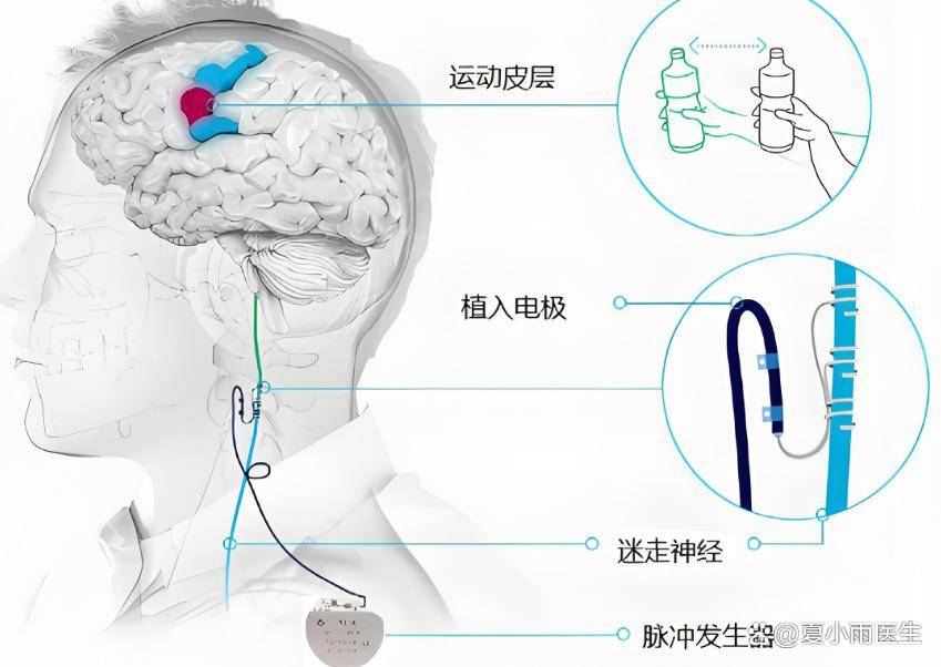 脑神经营养疗法：激活脑力潜能，重塑记忆与认知防线